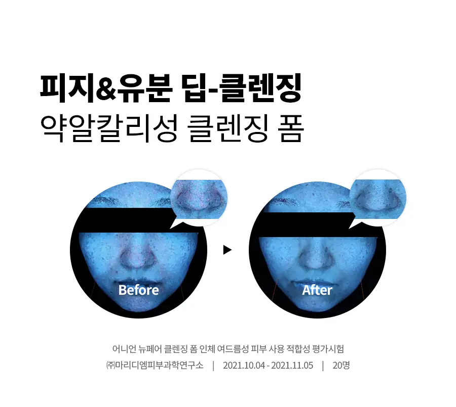 [이즈앤트리X몰티즈] 이즈앤트리 어니언 뉴페어 클렌징폼 150ml 기획 (+스마트톡) 상세페이지 6